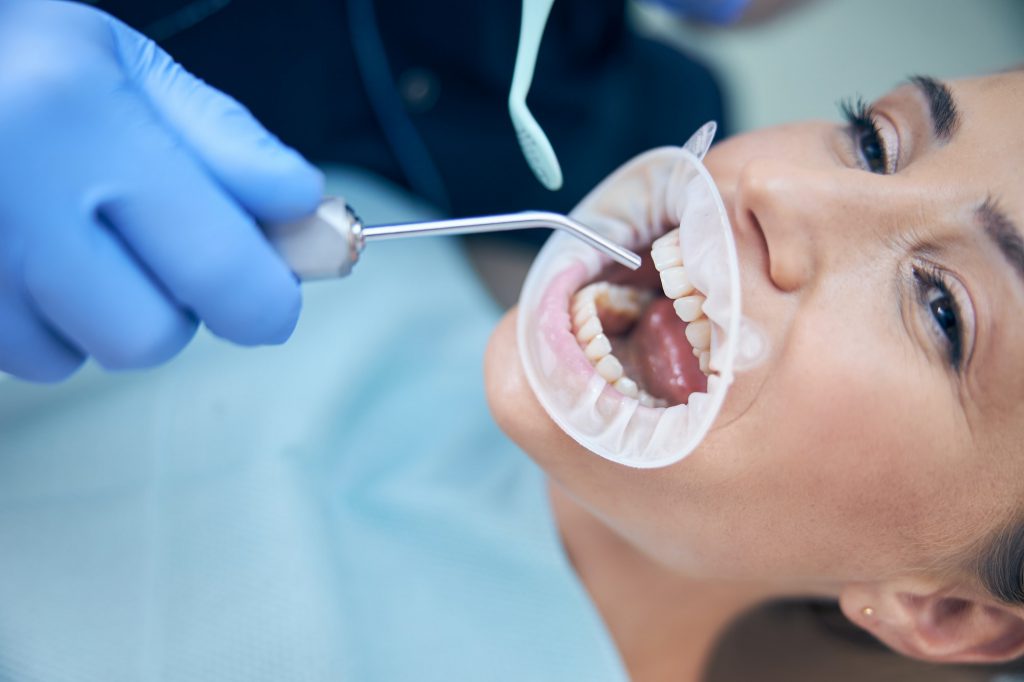 Young woman having teeth treated in clinic